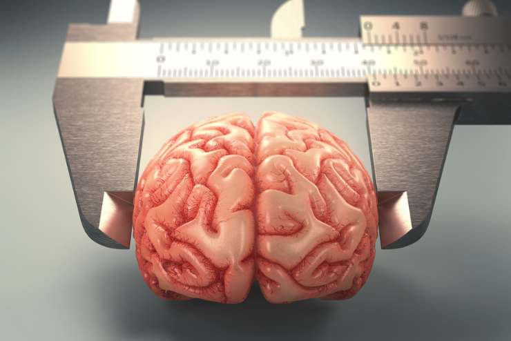 Vztah velikosti mozku a IQ